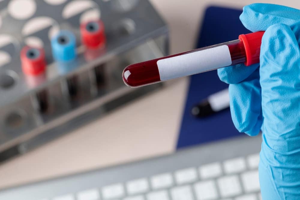 Could Alzheimer’s-Linked Proteins Transfer in Blood? The Latest Insights — Alzheimer’s blood transfusion risk