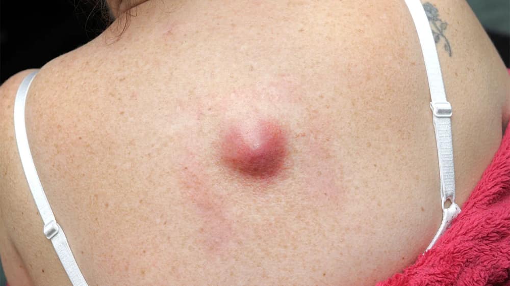 25 Subtle Body Signals You Should Never Ignore — body warning signs