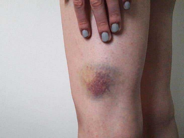 25 Subtle Body Signals You Should Never Ignore — body warning signs